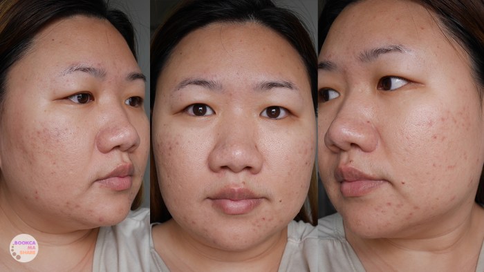 apex-profound-beauty-acen-ppp-beauty-fast-lane-01