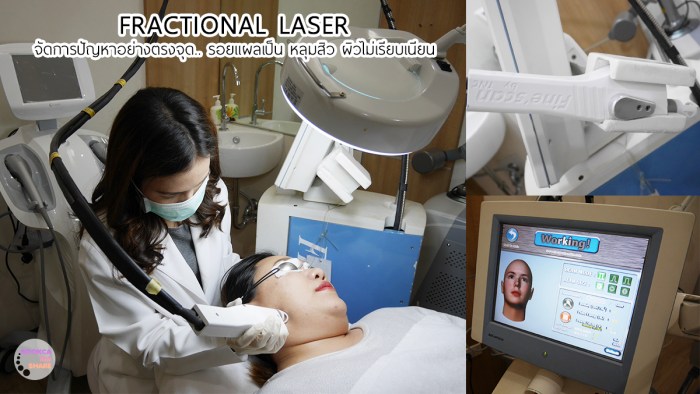 apex-profound-beauty-acen-ppp-beauty-fast-lane-05