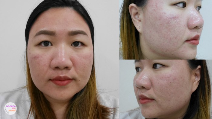 apex-profound-beauty-acen-ppp-beauty-fast-lane-06