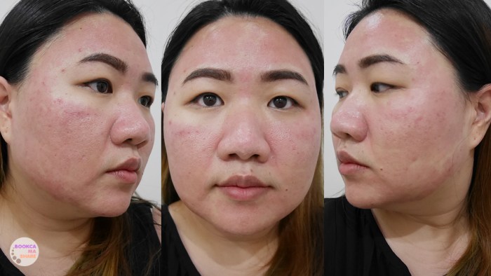 apex-profound-beauty-acen-ppp-beauty-fast-lane-11