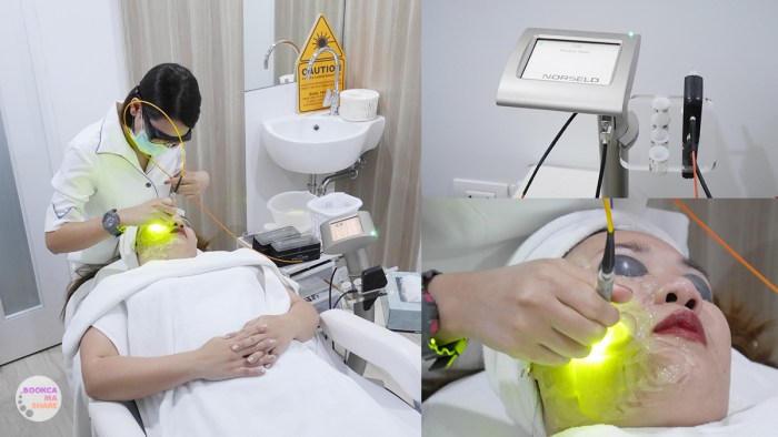 apex-profound-beauty-acen-ppp-beauty-fast-lane-16