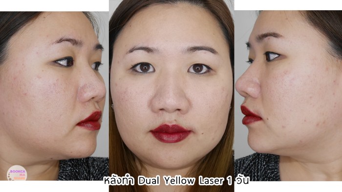 apex-profound-beauty-acen-ppp-beauty-fast-lane-18