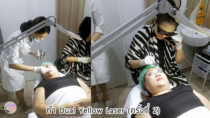 apex-profound-beauty-acen-ppp-beauty-fast-lane-21