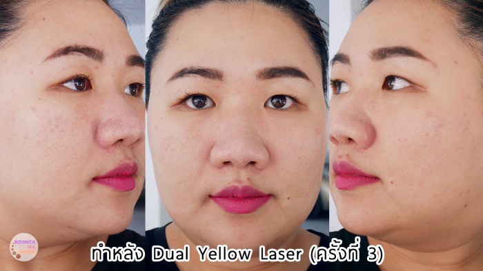 Apex-Profound-Beauty-acen-ppp-beauty-fast-lane-22-2