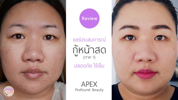 Apex-Profound-Beauty-acen-ppp-beauty-fast-lane