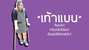 Review-flat-feet-Health-s